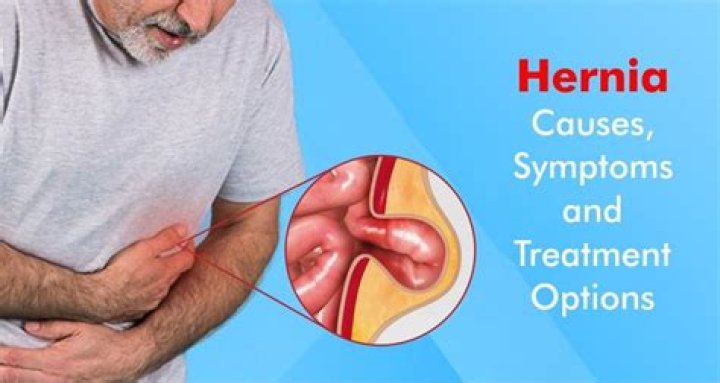 Can a hernia cause hip pain?