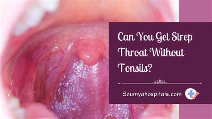 Can a person without tonsils get tonsillitis?