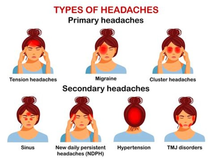 Can aneurysm headaches come and go?