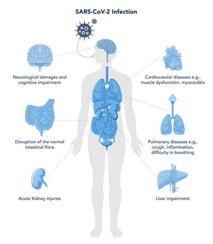 Can COVID-19 be detected by CT scan?