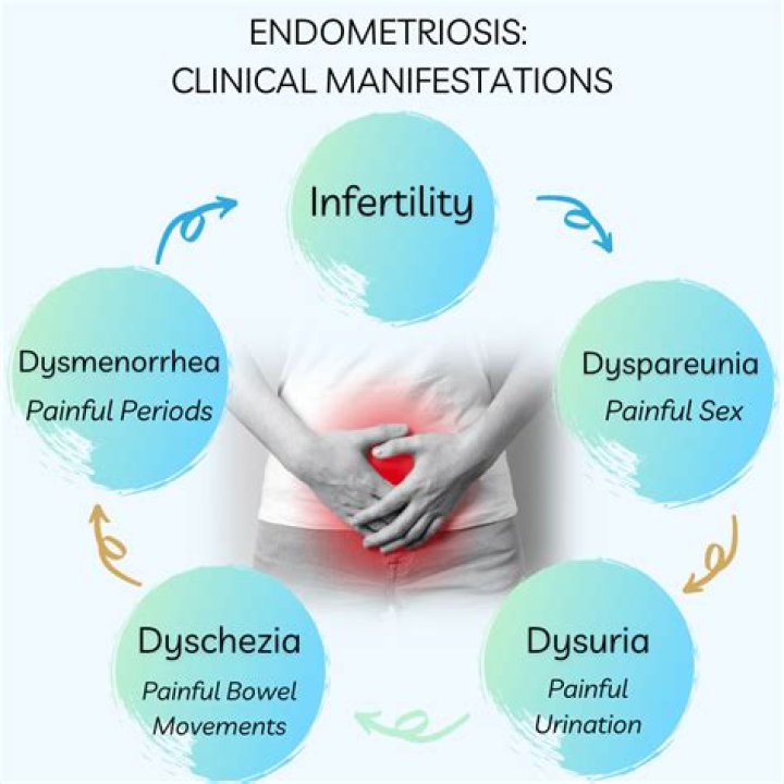 Can endometriosis cause UTI symptoms?