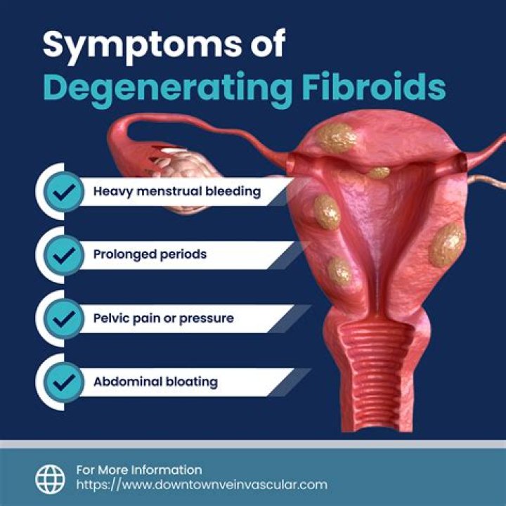 Can fibroids be caused by abortion?