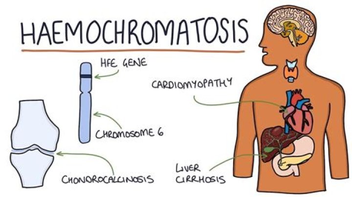 Can hemochromatosis cause mental problems?