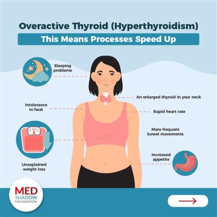 Can hypothyroidism affect your eyes?