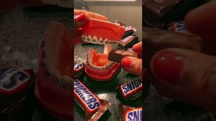 Can I eat Snickers with braces?