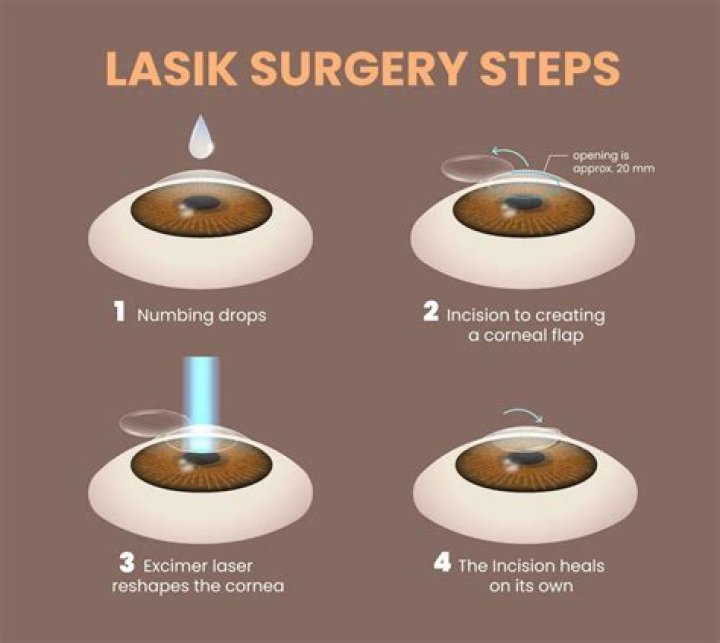 Can I sneeze after LASIK?