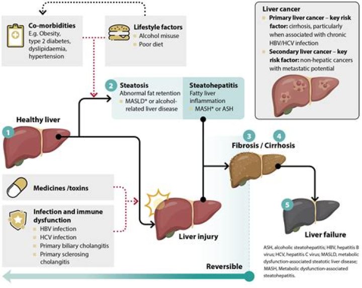 Can insulin damage your liver?