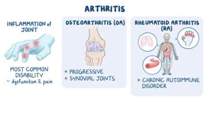 Can osteoarthritis turn into rheumatoid arthritis?