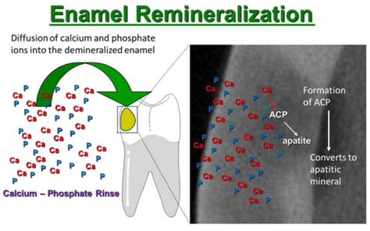 Can tooth enamel be Remineralized?