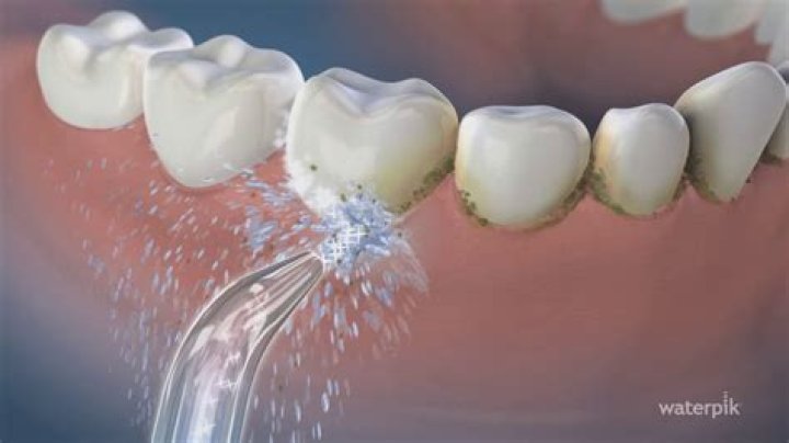 Can you damage your gums with a Waterpik?