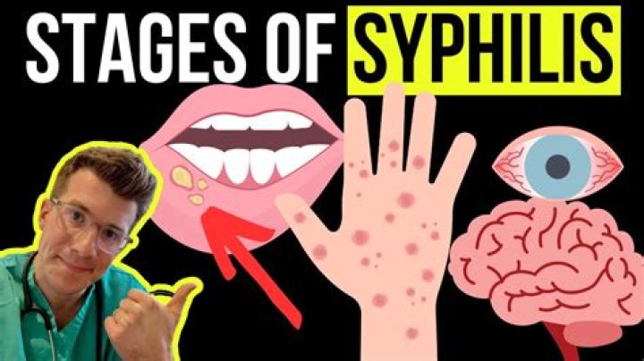 Can you get syphilis from saliva?