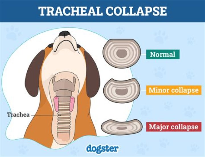 Do collars cause collapsed trachea?
