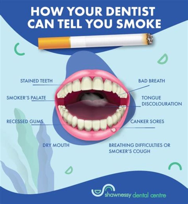 Do dentist know if you smoke?
