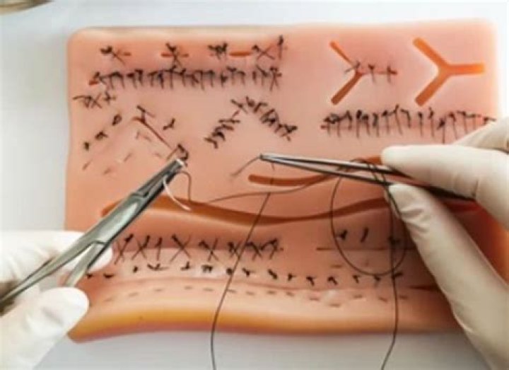 Do nurses do stitches?