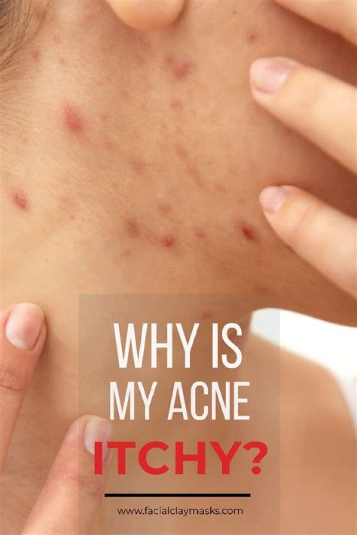 Do pimples itch?