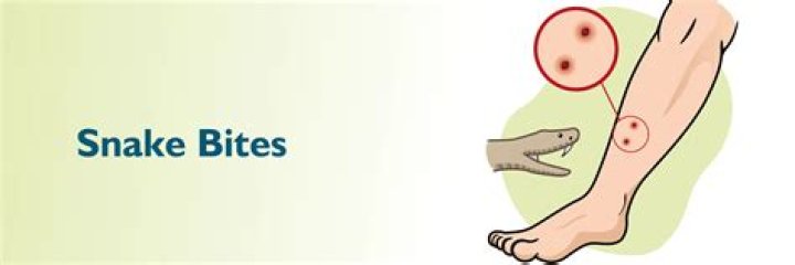 Do snakes bite above the knee?