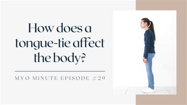 Do tongue-ties affect speech?