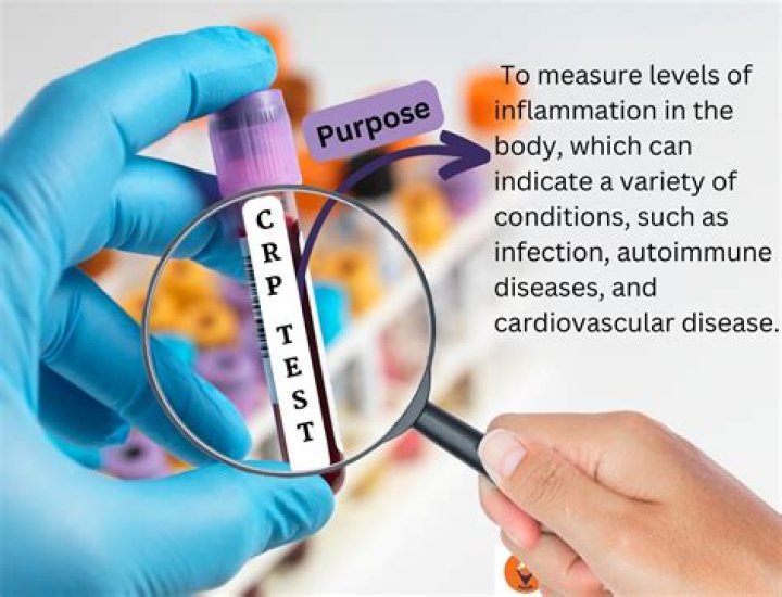 Does an elevated CRP indicate a specific disease?