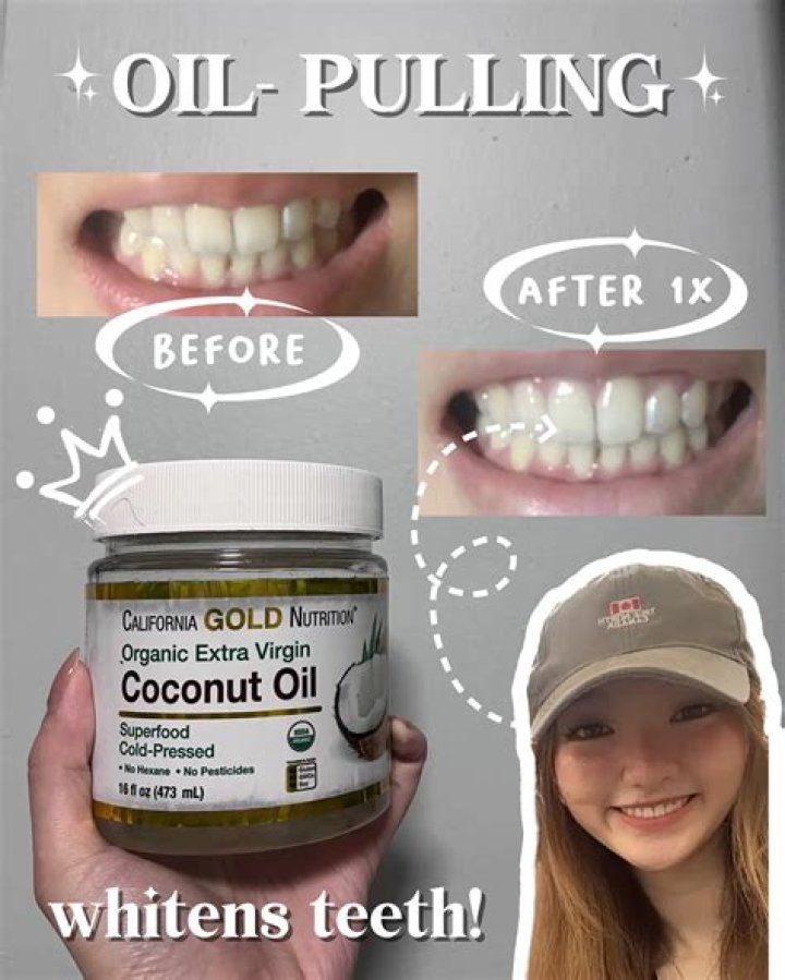 Does coconut pulling whiten teeth?