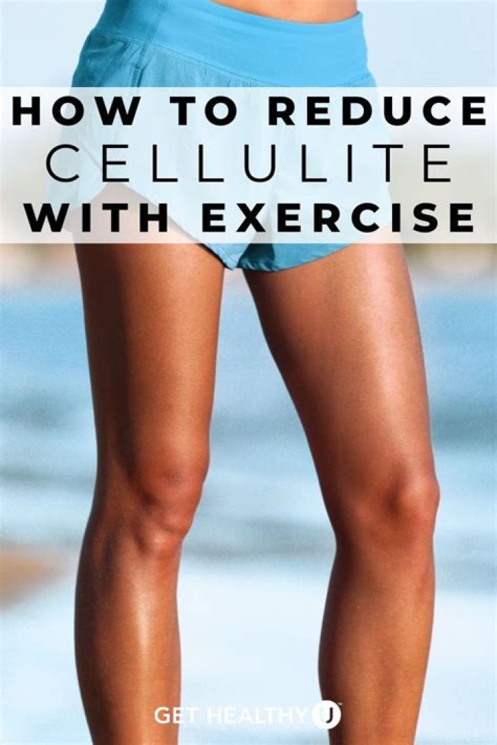 Does exercise reduce cellulite?