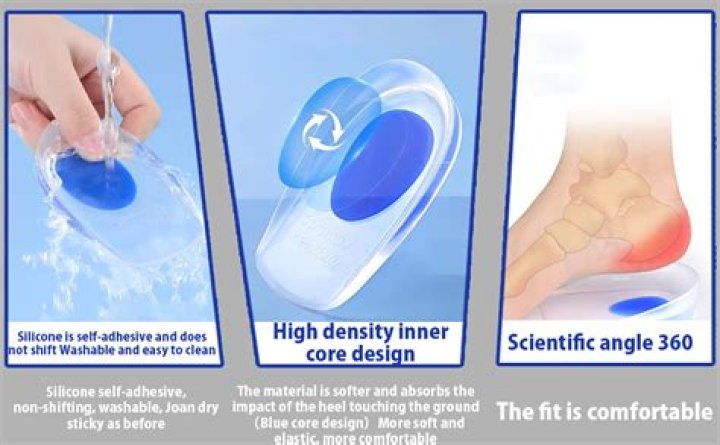 Does ibuprofen gel help plantar fasciitis?