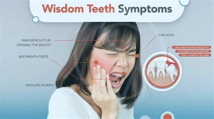 Does ibuprofen help wisdom tooth pain?
