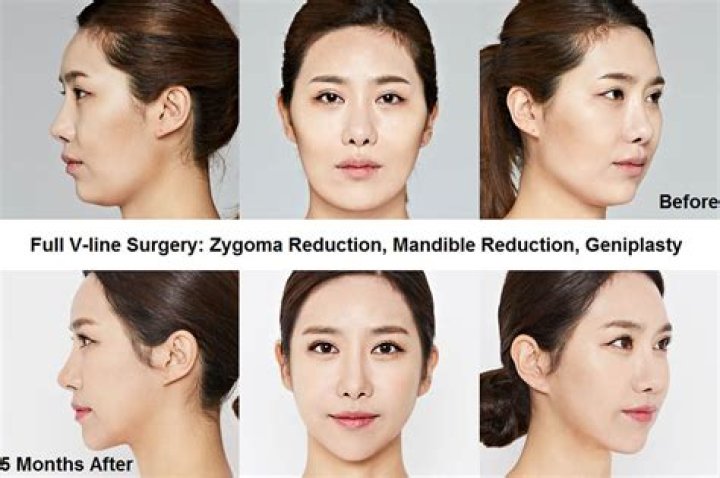 Does Korea have the best plastic surgeons?