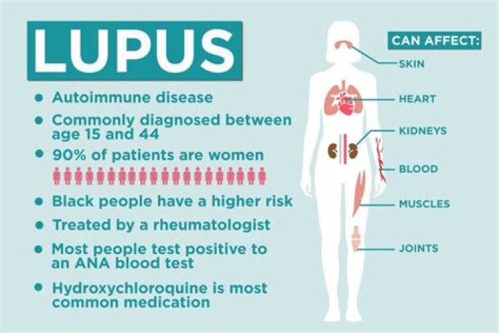 Does lupus affect your mind?