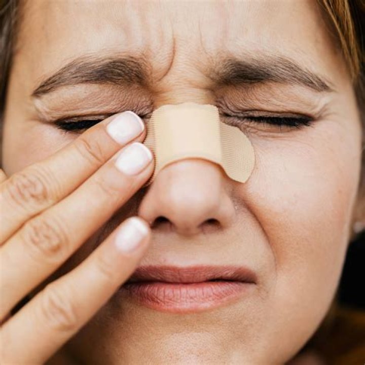 Does Medicare cover a broken nose?