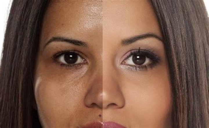 Does tanning permanently darken skin?