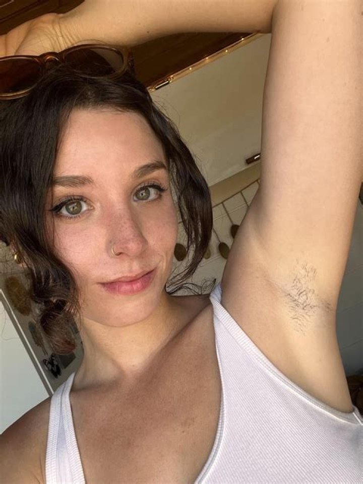 Does witch hazel help with dark armpits?