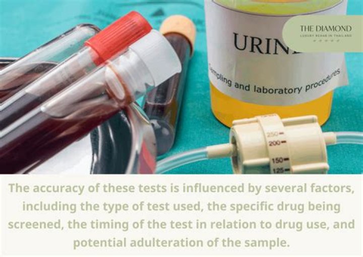 How accurate are urine drug tests?