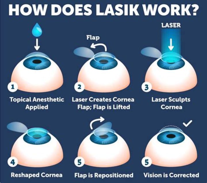 How can I get LASIK cheaper?