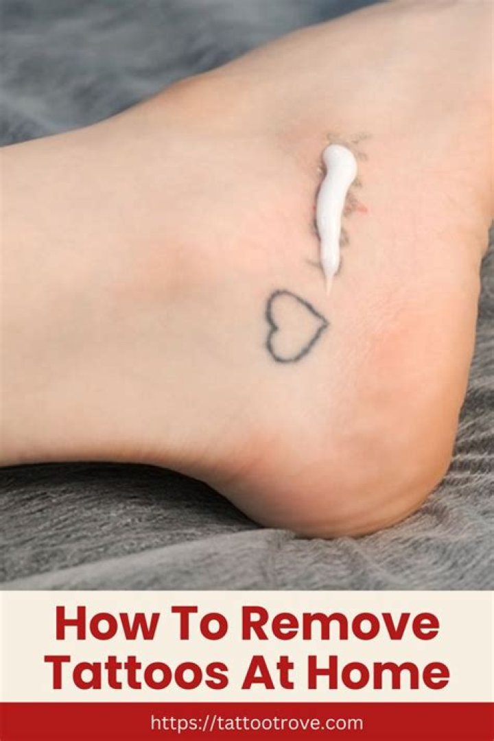 How can I remove a tattoo at home?