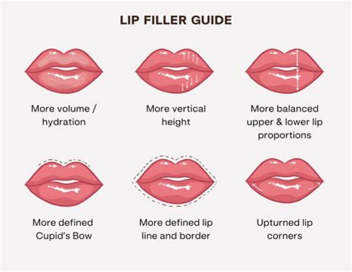 How do you eat with lip fillers?