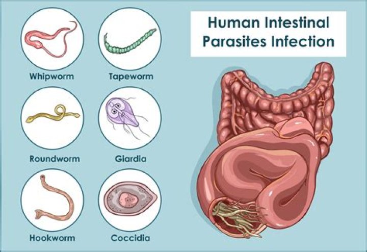 How do you know if you have a parasite in your stomach?