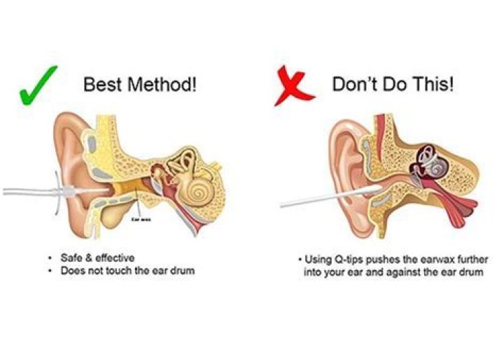 How do you know if you have ear wax build up?