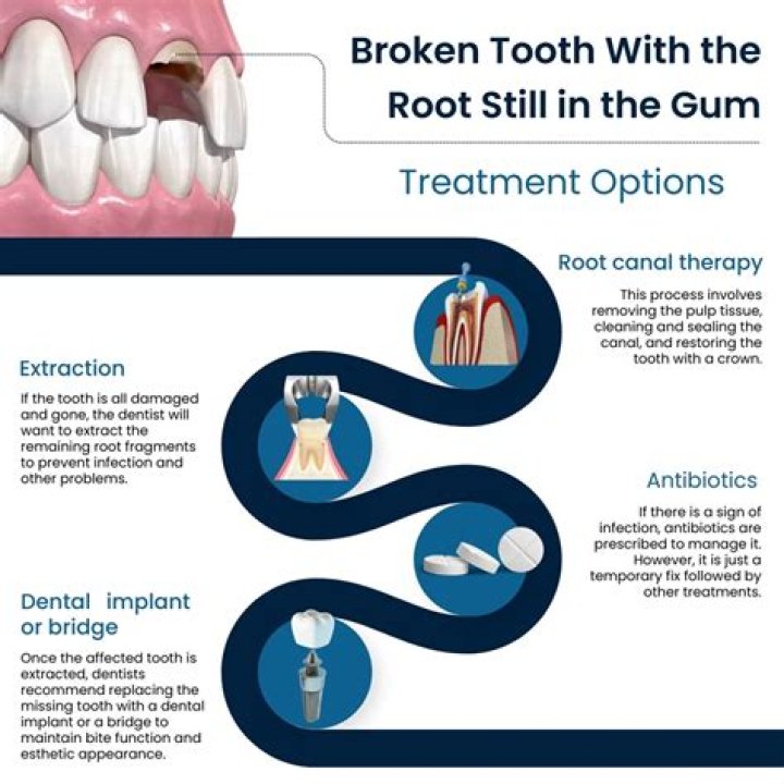 How do you remove a broken tooth at home?