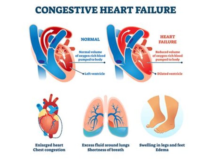 How do you test for heart failure?