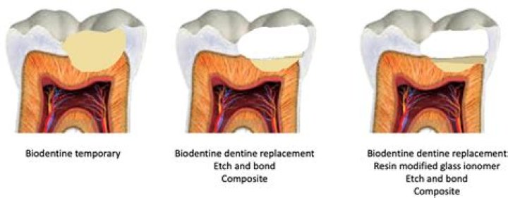 How does Biodentine bond to tooth?
