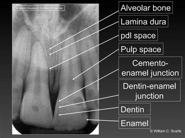 How does cementum appear on a radiograph?