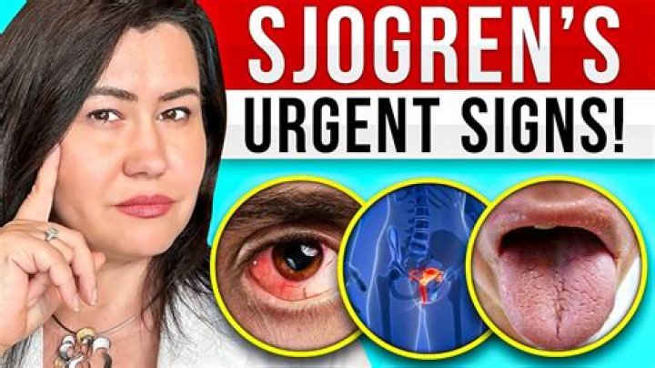 How does Sjogren's affect the throat?