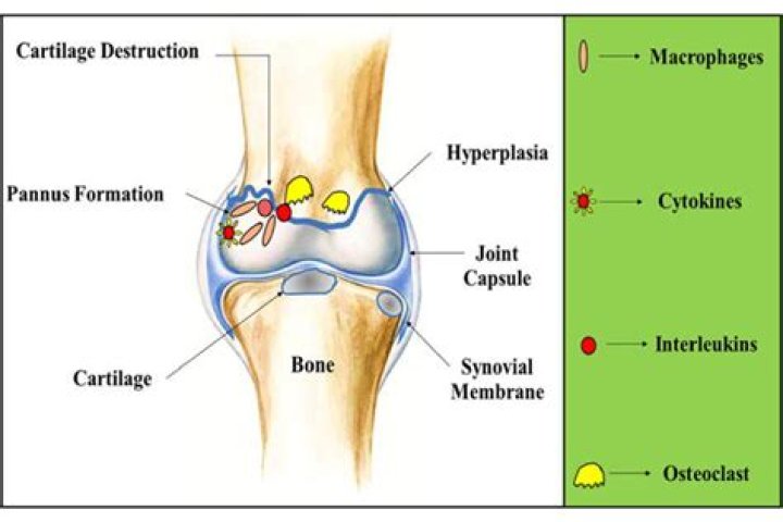 How does the pannus destroy a joint?