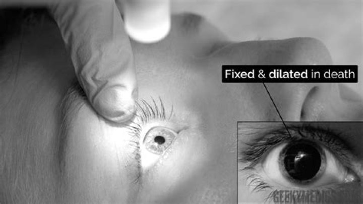 How long after death does a body turn black?