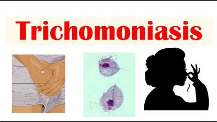 How long can a man carry trichomoniasis?