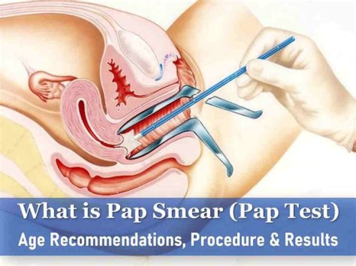 How long does a Pap smear take?