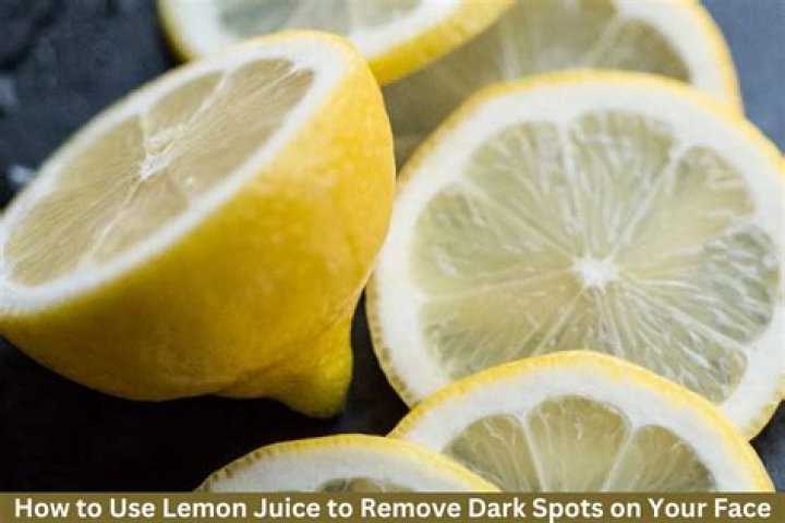 How long does it take for lemon juice to remove a wart?
