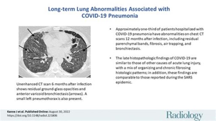 How long does pneumonia from Covid last?