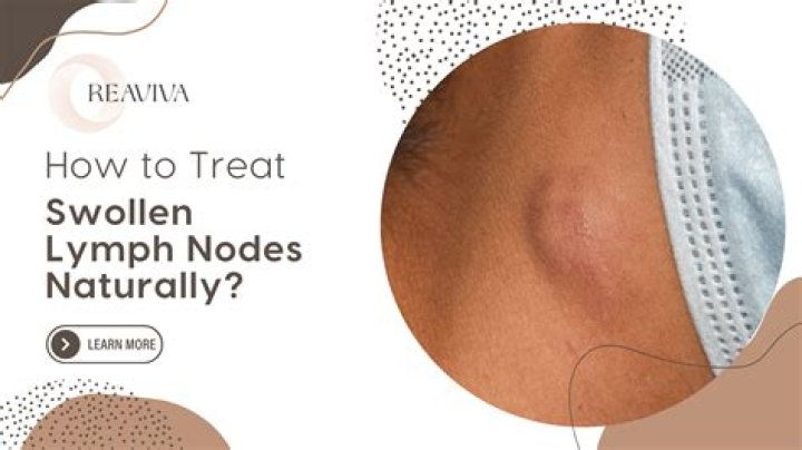 How long should a lymph node be swollen?
