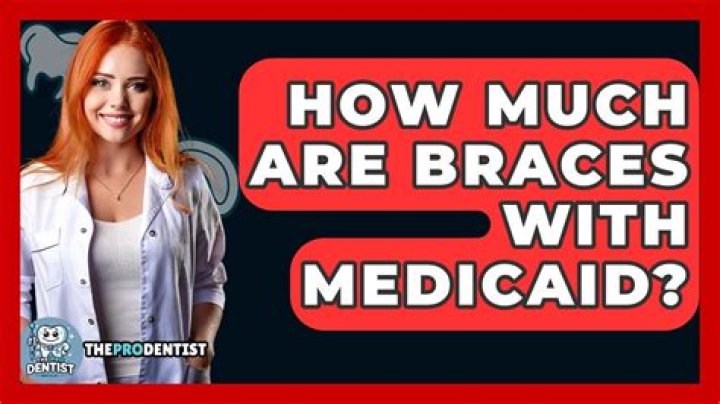 How much are braces with Medicaid?